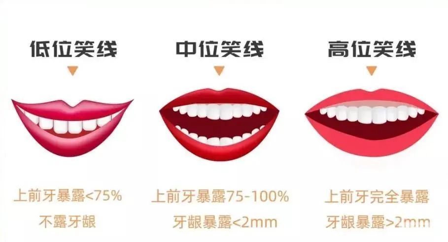 摘下口罩老20岁，竟然是因为你的下排牙?? 图片-5