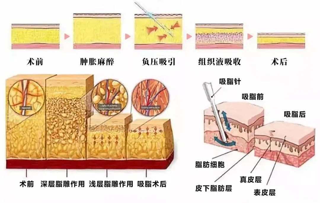 每次减肥都是3分钟热度的姐妹们，看看这个吧 图片-9