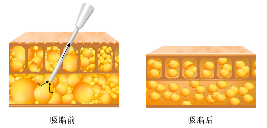 每次减肥都是3分钟热度的姐妹们，看看这个吧 图片-4