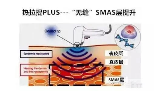 【抗衰干货】解锁25+后的​抗衰秘密，『分层抗衰』攻略了解一下~ 图片-11