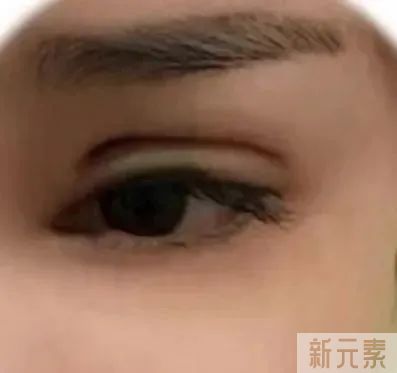 期待“卧蚕”却被做成“眼袋”?原因可能就这一点 图片-3