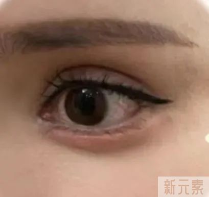 期待“卧蚕”却被做成“眼袋”?原因可能就这一点 图片-4