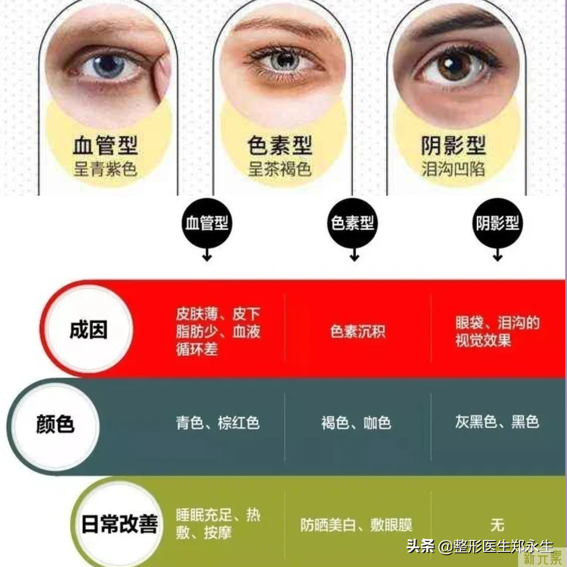 记住这些，黑眼圈不再是难题 图片-1
