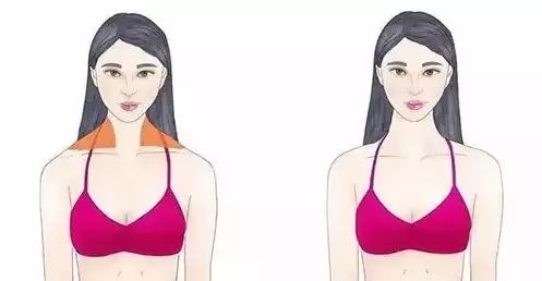 斜方肌发达的姐妹如何塑造“美人背”，实现露肩衣服的自由 图片-7