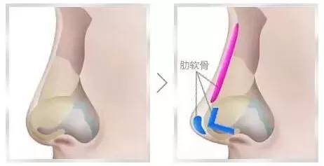 事实告诉你，美鼻真的是颜值buff 图片-14