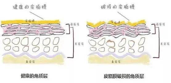 水光停用之后，皮肤会变得更差吗? 图片-2