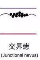 当经典“黑白配”长在了人的身上，你知道这其实是一种疾病吗? 图片-5