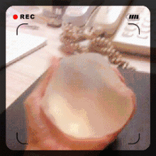 选择困难症:自体脂肪还是假体 图片-7