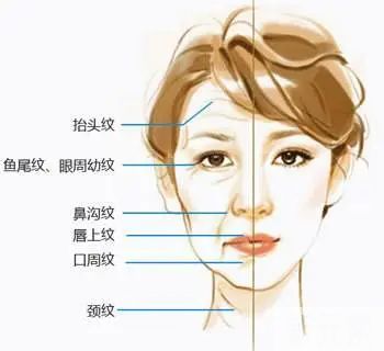 轻中重度面部衰老表现有哪些，20+抗衰早吗 图片-9