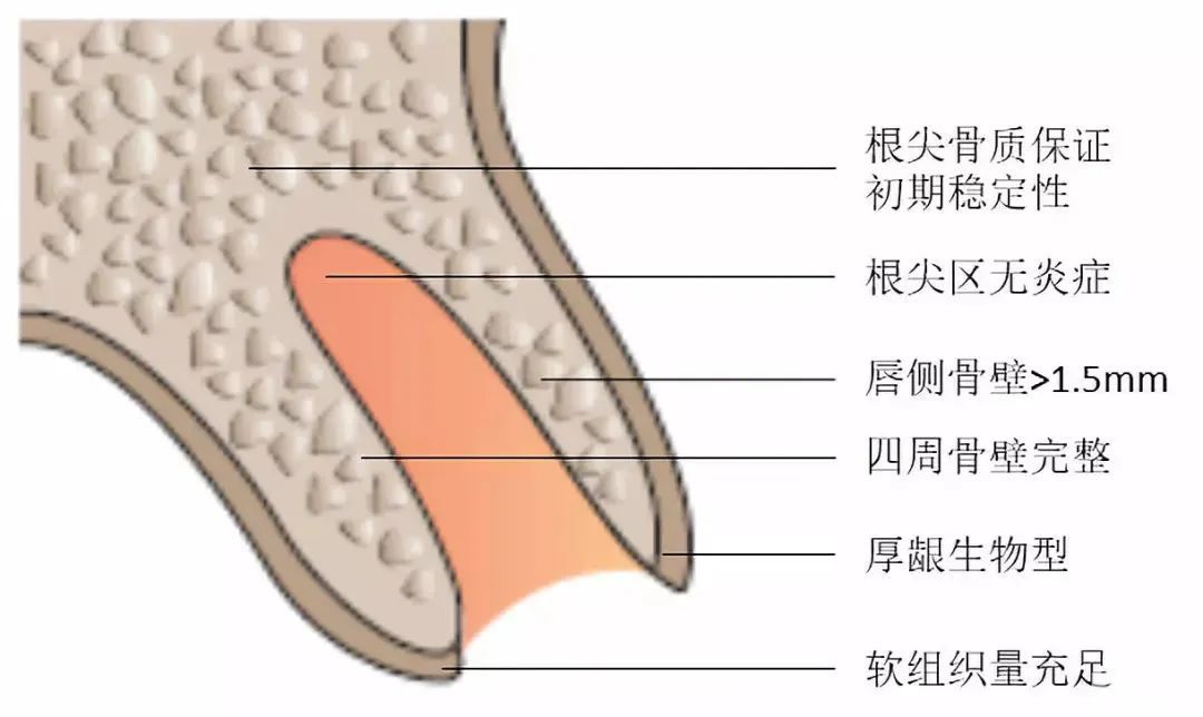 即刻种植VS传统种植，有什么区别，你更适合哪一个? 图片-7