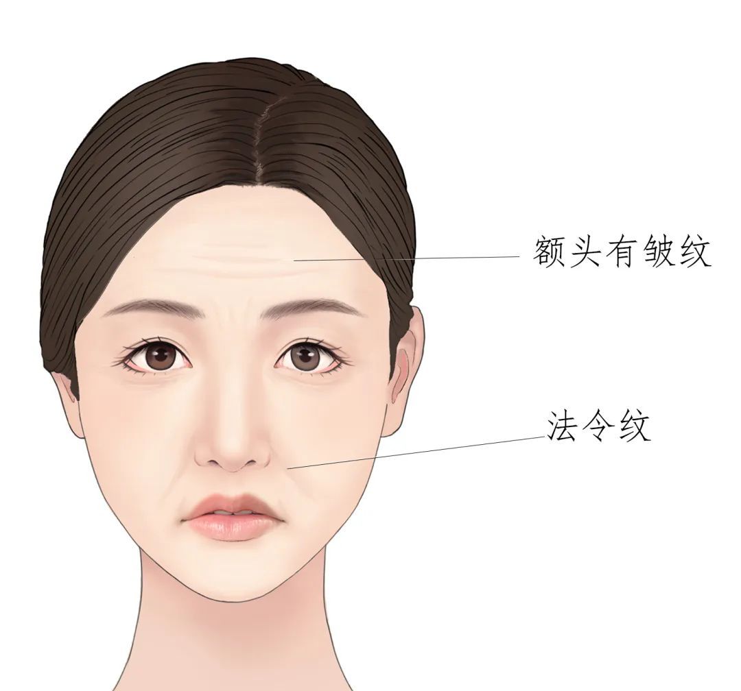 【玻尿酸】值得买吗?选哪种产品?你关心的都在这! 图片-23
