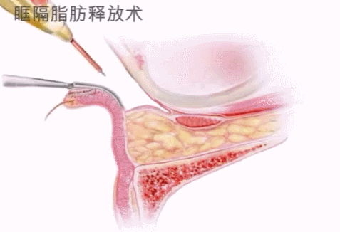 有眼袋泪沟的一定要看，瞬间年轻十岁 图片-1