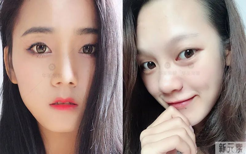 单眼皮有这5个特征，做双眼皮的钱都可以省了! 图片-4