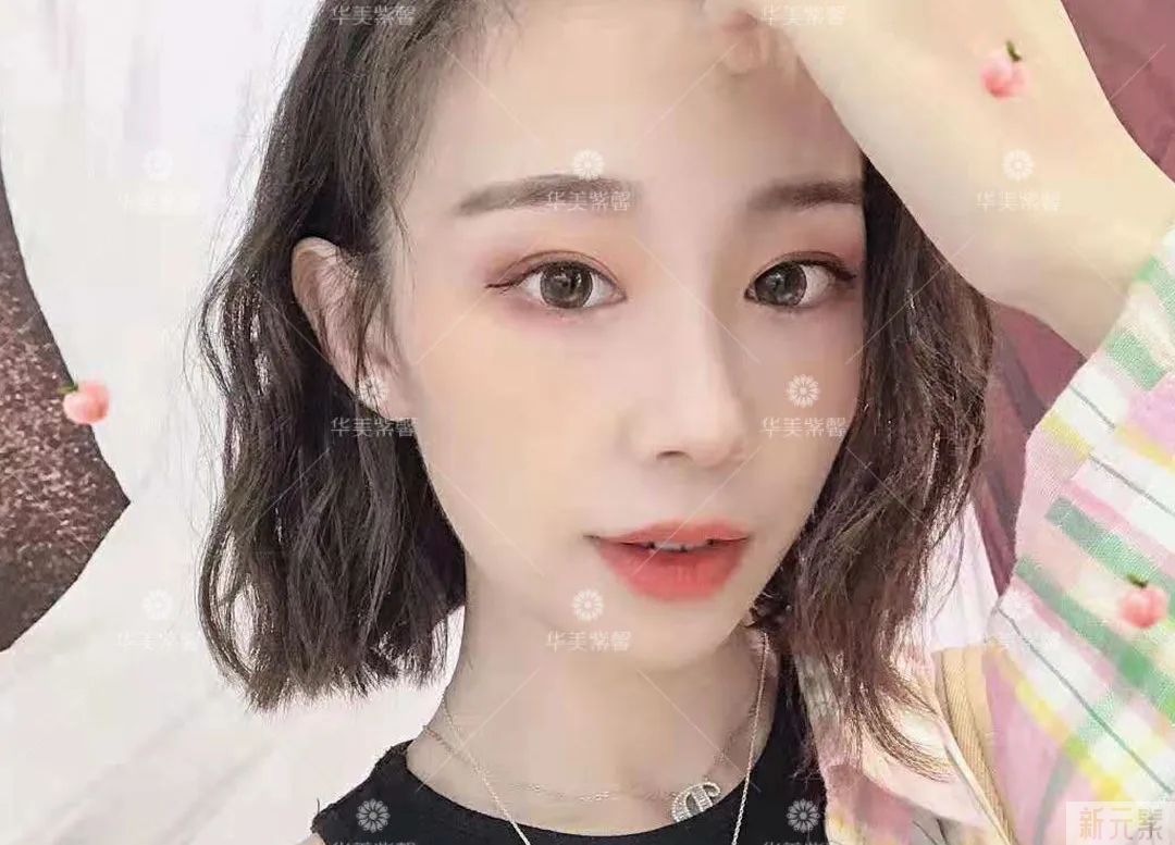 单眼皮有这5个特征，做双眼皮的钱都可以省了! 图片-14