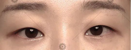 单眼皮有这5个特征，做双眼皮的钱都可以省了! 图片-13