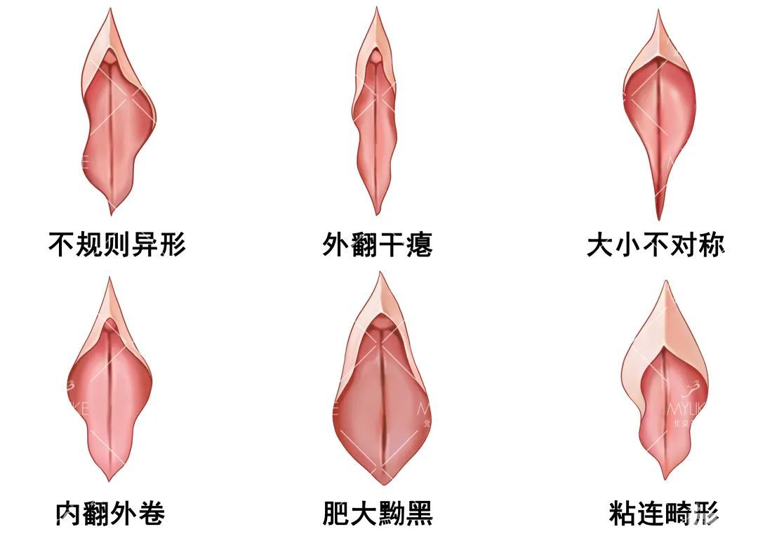 不能错过!女性必备的私密护理科普! 图片-10