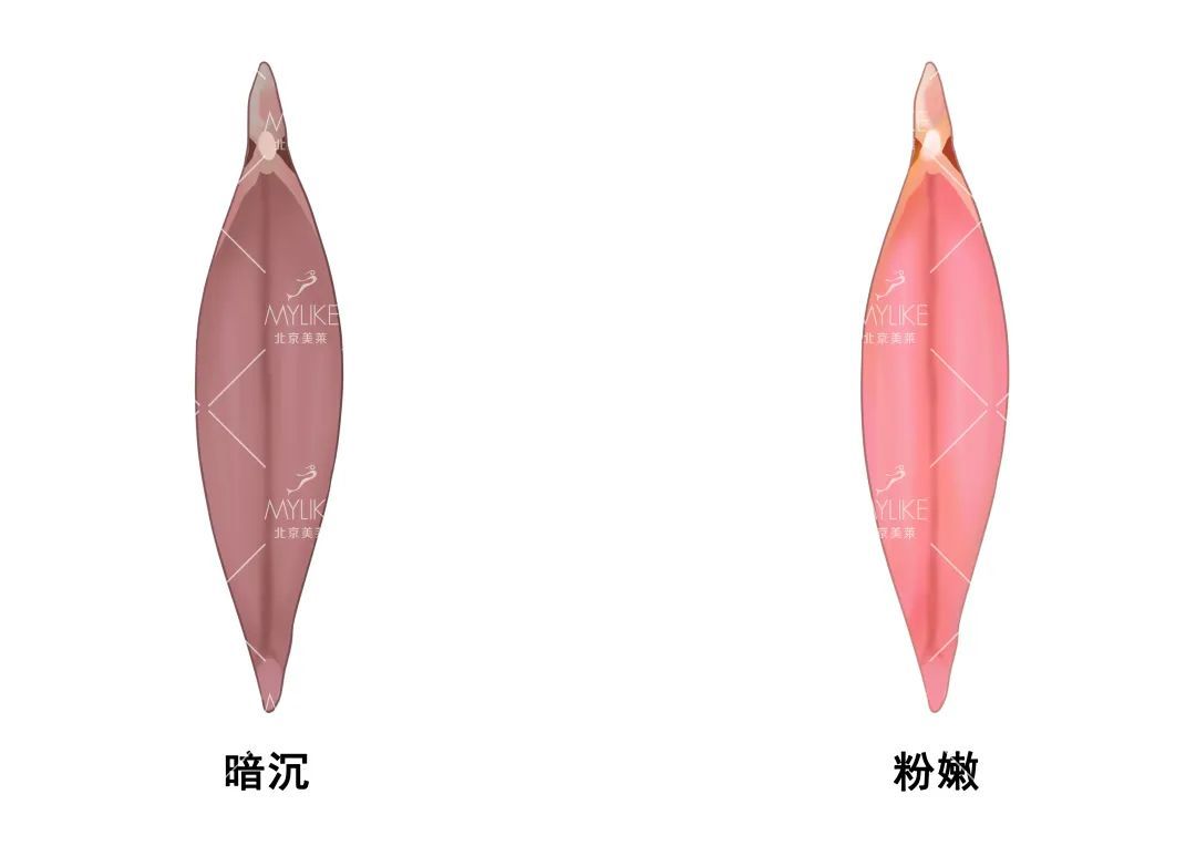 不能错过!女性必备的私密护理科普! 图片-9