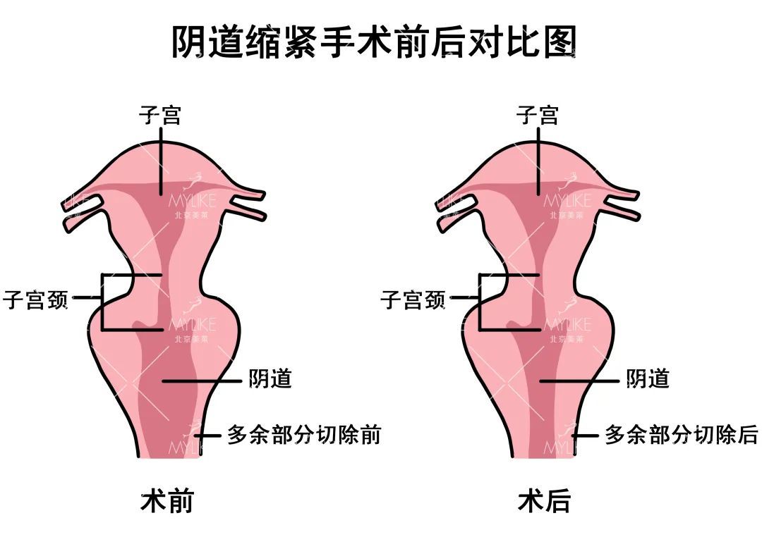 不能错过!女性必备的私密护理科普! 图片-8