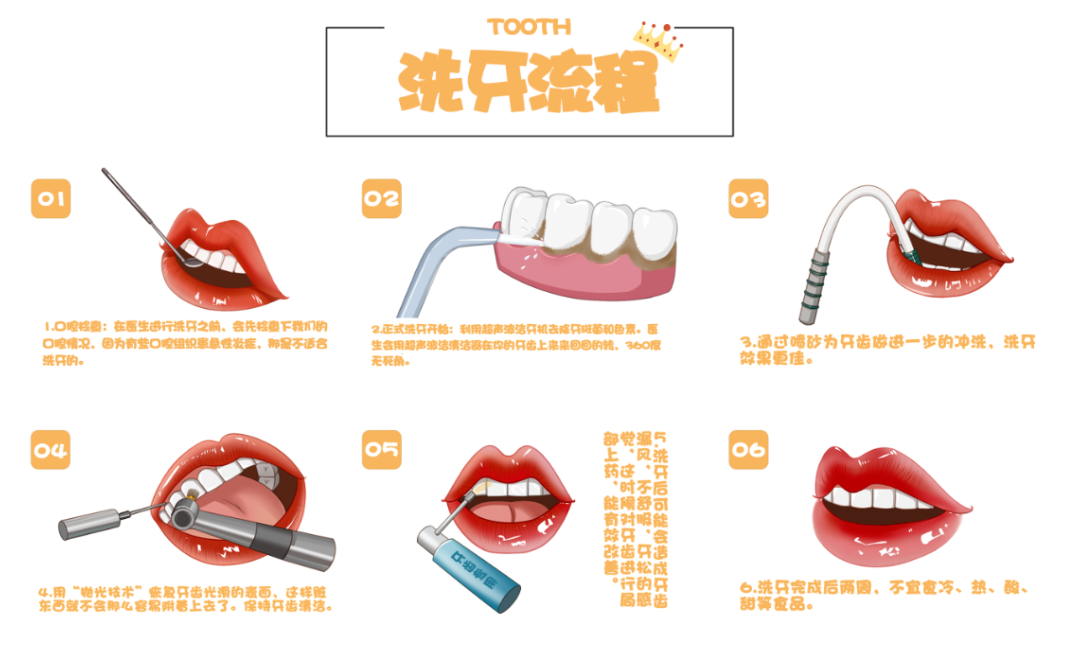 种牙先洗牙?注意，这可不是“多此一举”! 图片-5