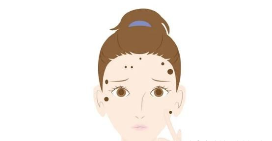 这样淡斑才有用! 图片-6