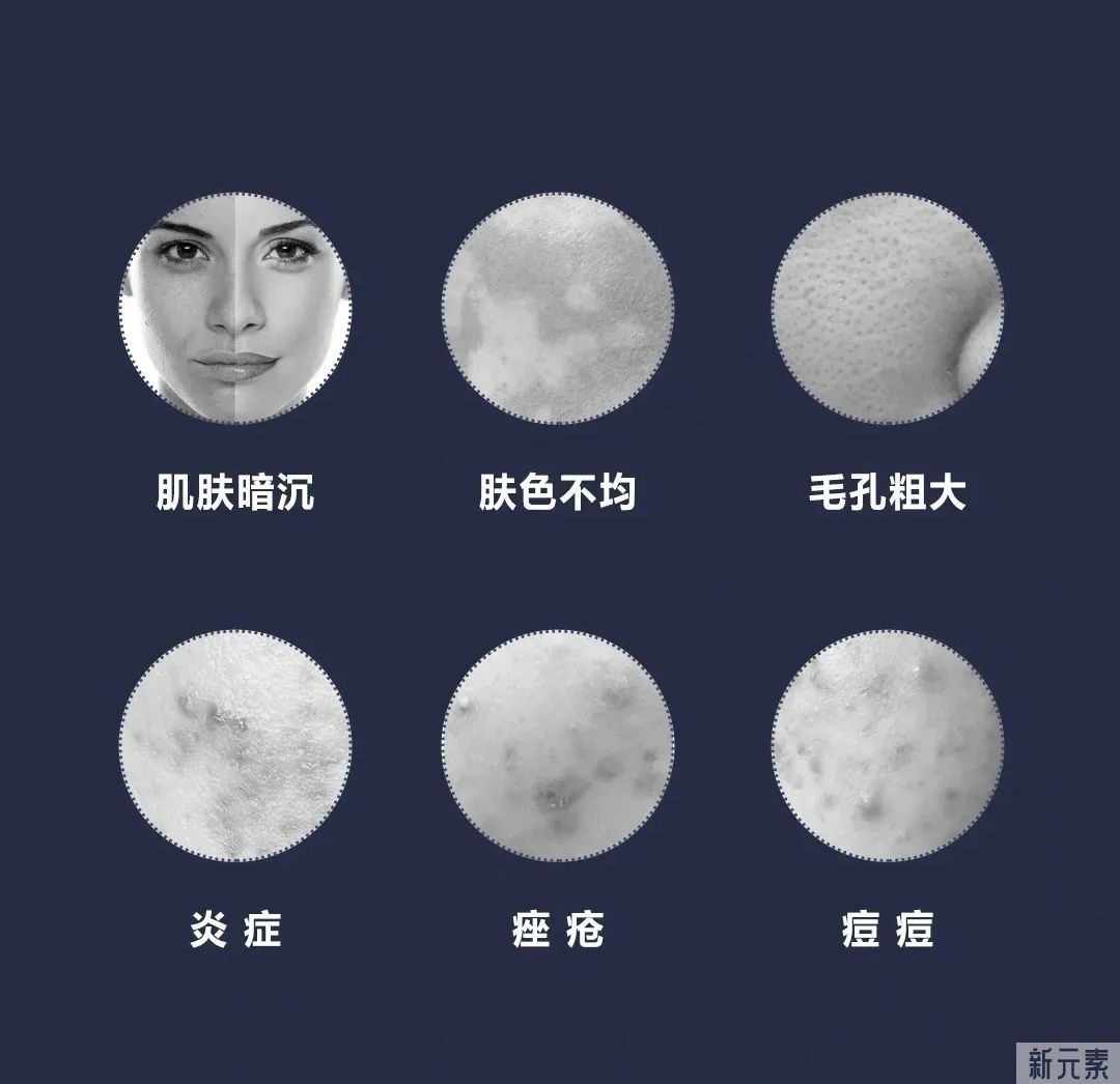 医美干货 | 保姆级光子嫩肤，高效CP=美肤加倍! 图片-5
