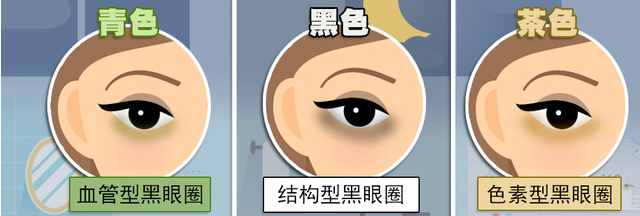 黑眼圈+泪沟，化妆都掩盖不住的显老BUG怎么破? 图片-3