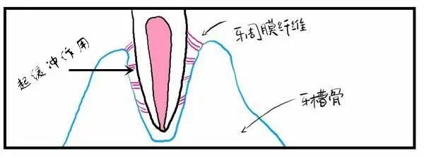 聊医聊 | 种植牙与真牙之间的区别? 图片-5