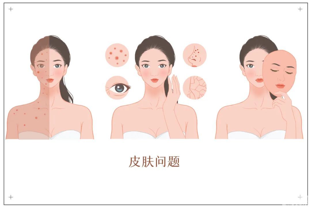皮肤暗沉无光怎么破? 图片-1