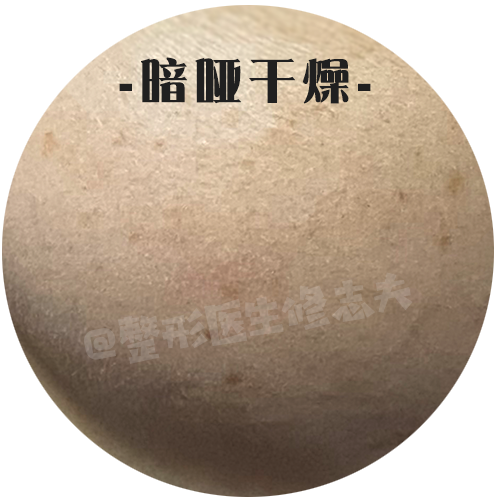 干纹、卡粉、起皮?护肤方法该注意了 图片-10