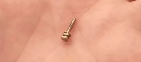 小身躯大作用，这个正畸利器了解下! 图片-2
