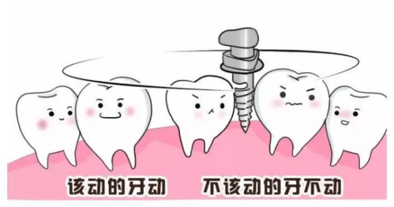 小身躯大作用，这个正畸利器了解下! 图片-3