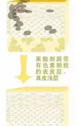 建议收藏丨果酸焕肤，油痘皮的小仙女赶紧打开看看! 图片-11