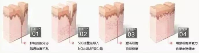 建议收藏丨果酸焕肤，油痘皮的小仙女赶紧打开看看! 图片-15