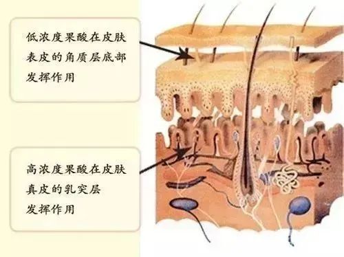 建议收藏丨果酸焕肤，油痘皮的小仙女赶紧打开看看! 图片-14