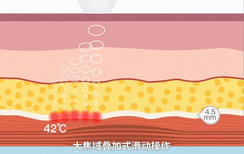 5年前风靡富婆圈的“提拉神器”，竟然重金属超标80倍... 图片-9