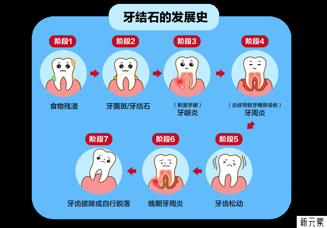 医生说:“建议你洗牙”，究竟是为你好?还是坑你? 图片-5
