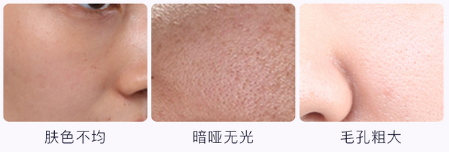 美肤抗衰专场|敏感肌/油痘肌/毛孔粗大/黑黄皮...攻略已奉上，小伙伴们速速查收 图片-10
