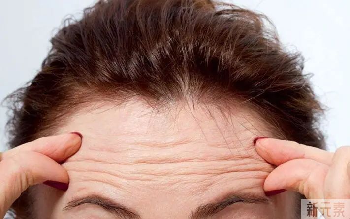 她来改善抬头纹，却被忽悠做了眼睛!? 图片-1