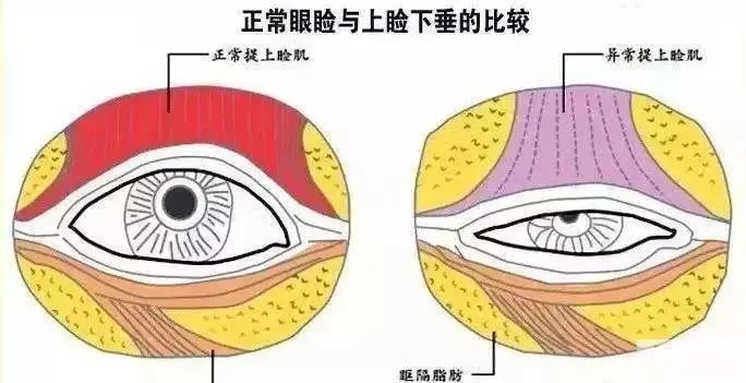 她来改善抬头纹，却被忽悠做了眼睛!? 图片-5