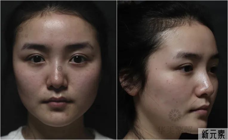 良心特推网红都爱打卡的平价嫩肤项目! 图片-3