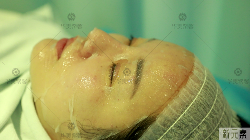良心特推网红都爱打卡的平价嫩肤项目! 图片-9