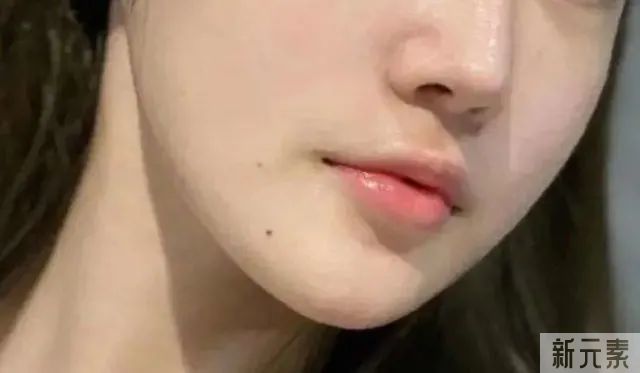 坚持打1年的水光，皮肤会变成什么样? 图片-2