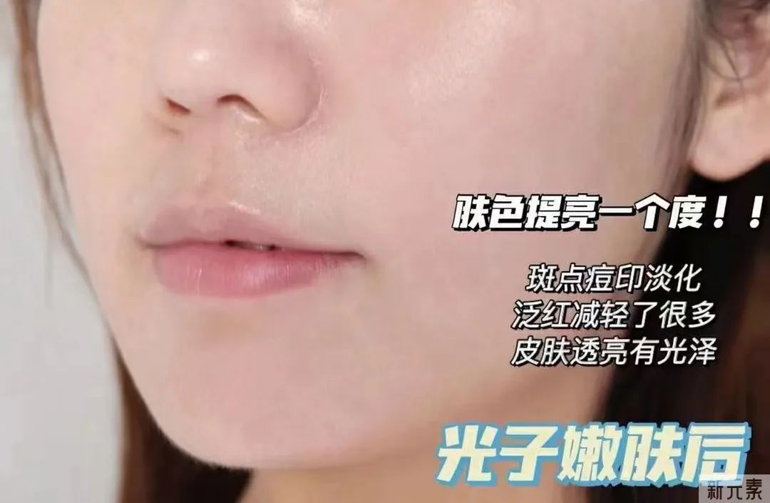 拒绝护肤“摆烂”，这一次我一定要赢! 图片-9