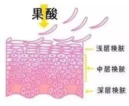 会刷酸的人皮肤都变好了，前提是搞清楚这些~ 图片-3
