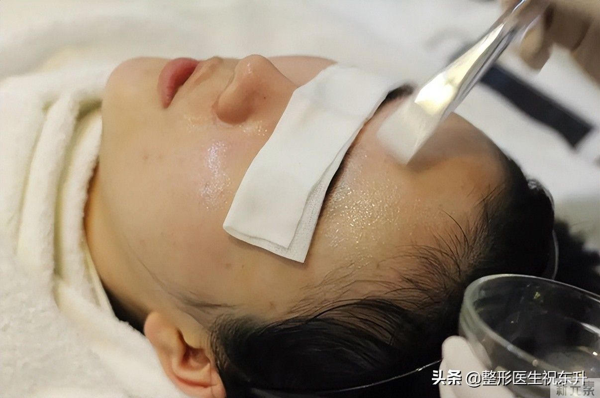 给你一份性价比高的医美抗衰清单(医生总结得很实用) 图片-3