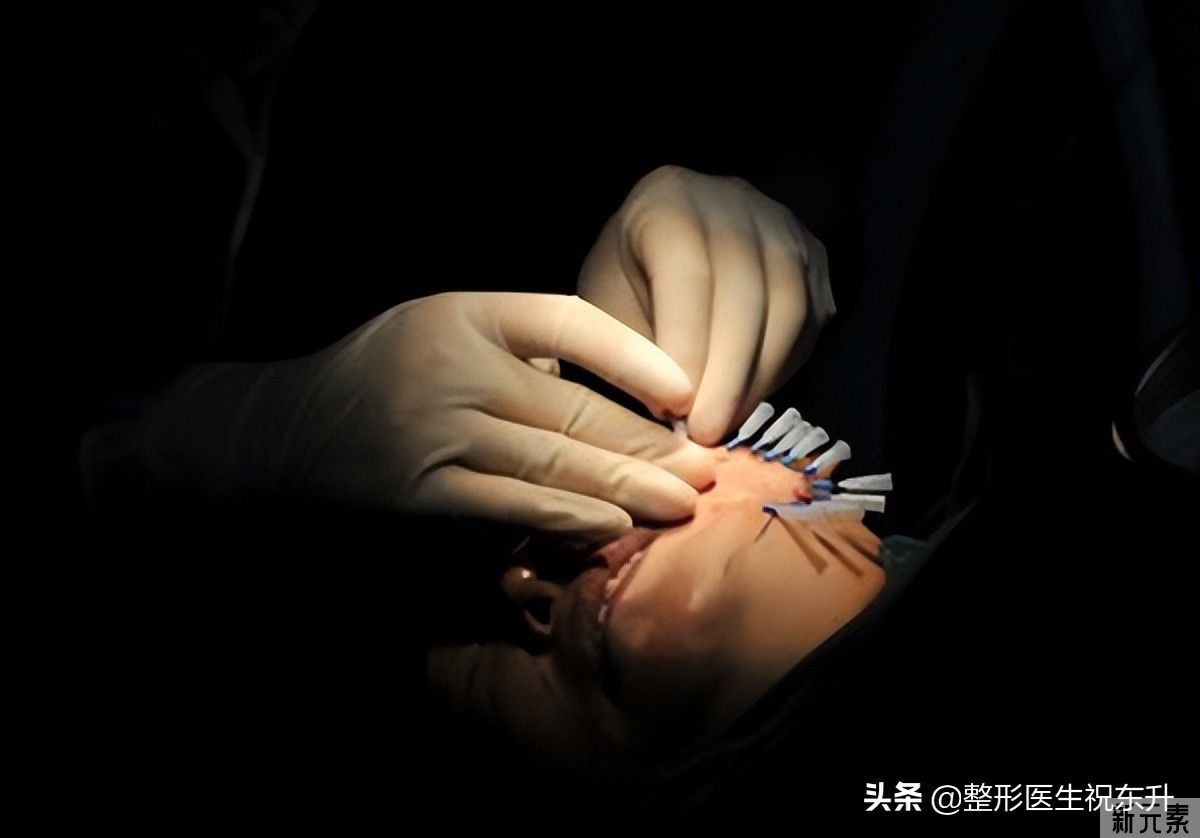 给你一份性价比高的医美抗衰清单(医生总结得很实用) 图片-4