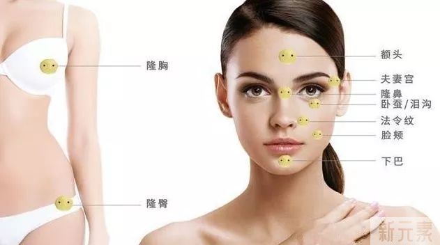 自体脂肪填充后脂肪被吸收了怎么办? 图片-3