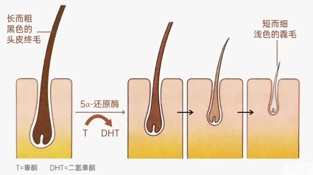 说实话|不能植发VS不用植发 图片-2
