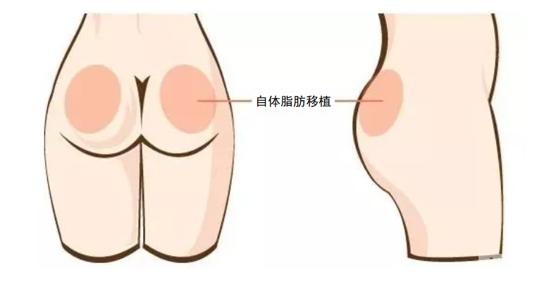 深蹲练蜜桃臀，当心臀没翘，腿却粗了... 图片-6