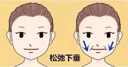 每个人的法令纹都有自己的脾气，具体成因具体改善 图片-7